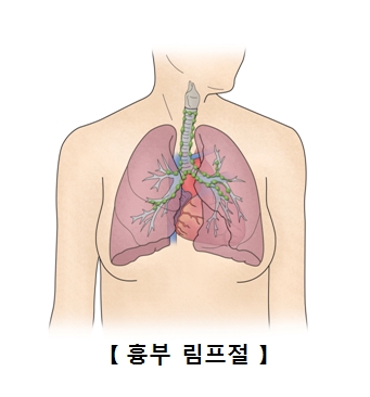 흉부 림프절